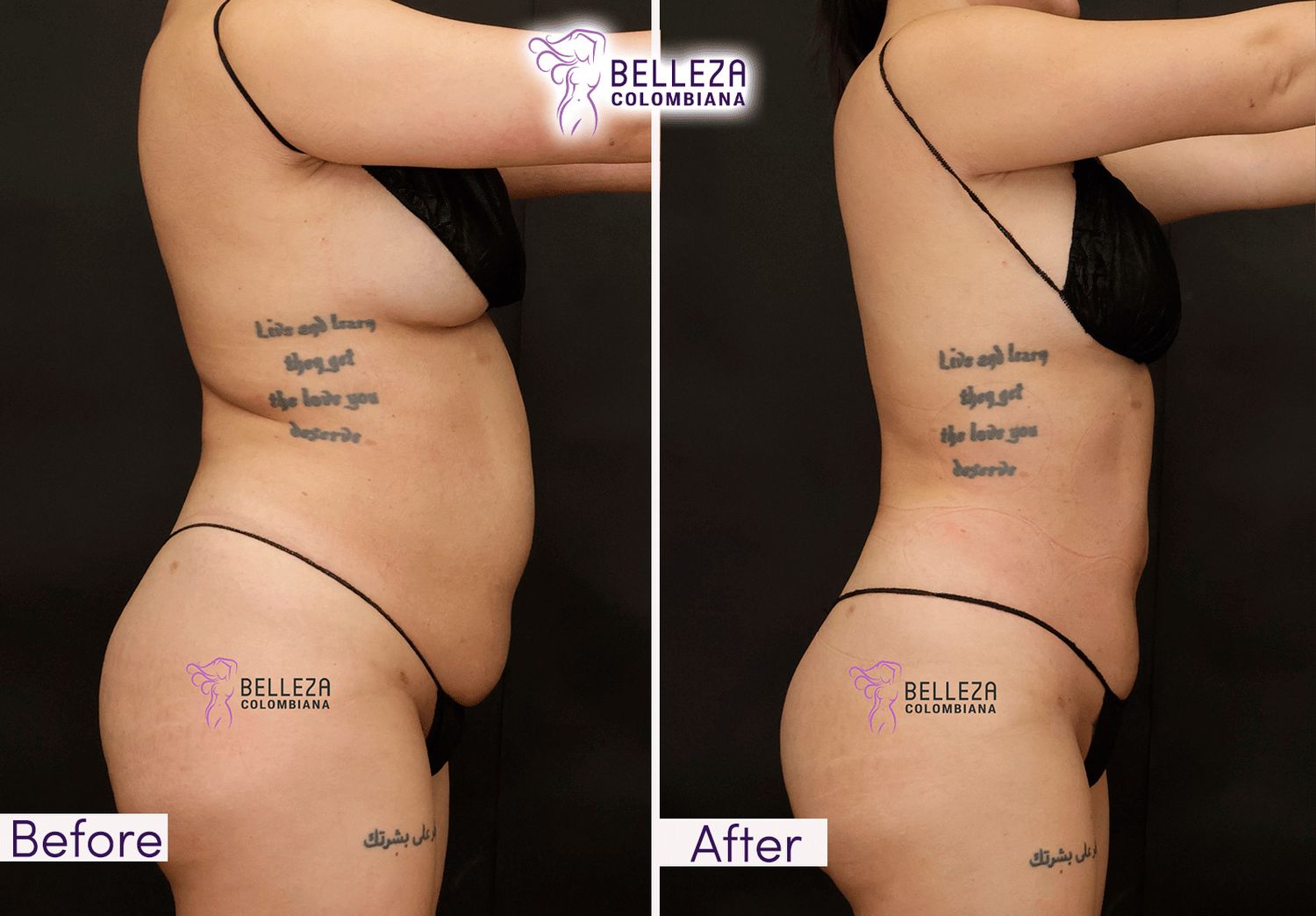 Body Countouring Before & After